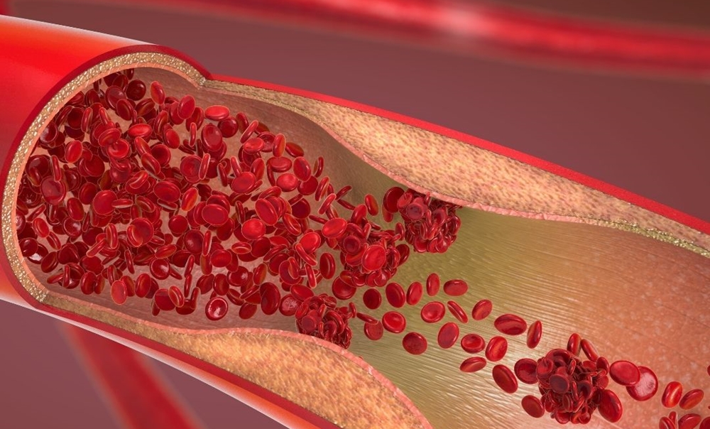 sintomas e causas da anemia